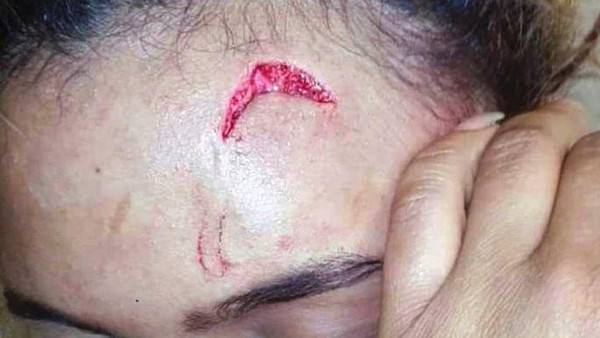 بالصور الصادمة - هذا ما فعلته السيدة الأولى بعارضة أزياء...