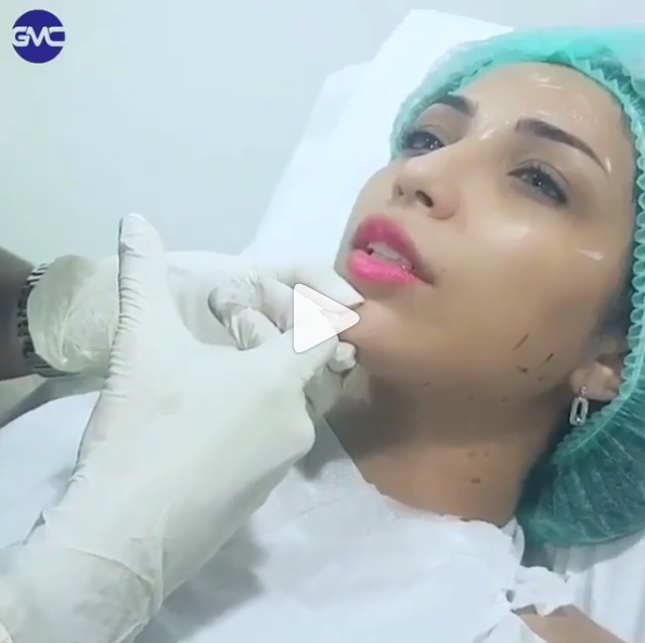 بالفيديو - دنيا بطمة تحت التجميل... لن تصدقوا عدد وأماكن الحقن!