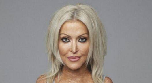 بالصور-  شعرت بالغيرة من جمالها فأحرقتها وشوّهت ملامحها... إليكم تفاصيل هذه الجريمة كما روتها الضحية