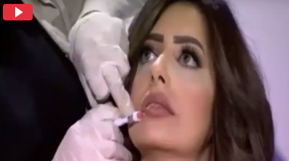 بالفيديو - إعلامية مصرية تخضع للتجميل وتكبير الشفاه على الهواء مباشرة!