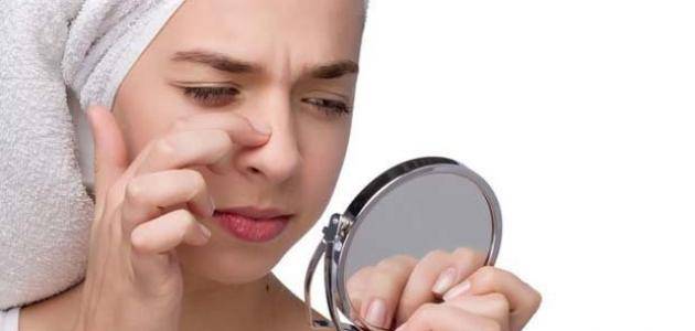 ودّعي مشلكة الرؤوس السوداء بهذه المواد الطبيعية... إليك الوصفة السحرية