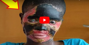 بالفيديو - عاد من بلد عربي ليشوه زوجته هكذا! اليكم التفاصيل المروّعة