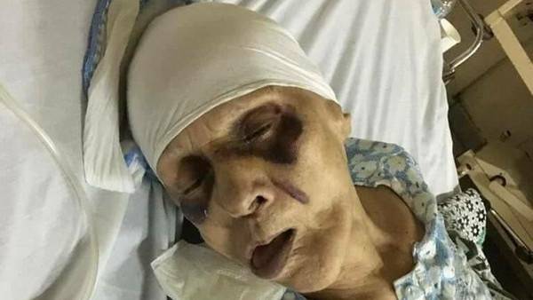 مسنة مصرية عذبها ابنها حتى الموت إرضاء لزوجته