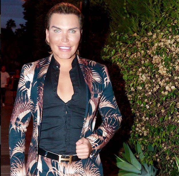 صور صادمة - شاهدوا كيف كان شبيه كين زوج باربي قبل عمليات التجميل!!